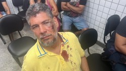 Cliente é agredido por funcionário de restaurante em shopping do Recife (foto: Arquivo pessoal)