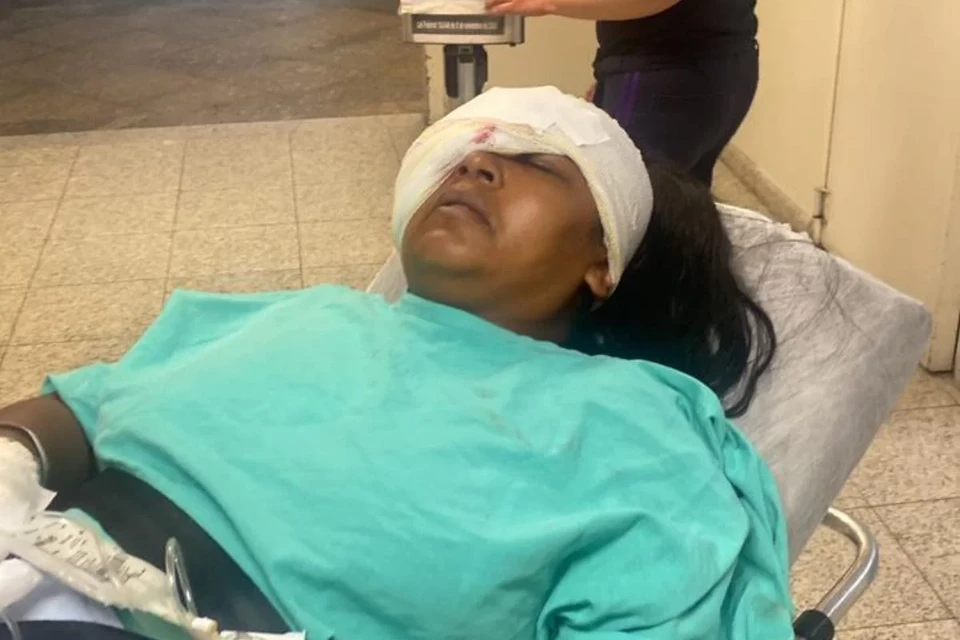 Daiane Cristina perdeu a visão do olho direito após ser baleada (foto: Acervo pessoal)