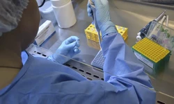 As informaes de segurana e imunogenicidade serviro de base para solicitar a aprovao do produto no Brasil na Agncia Nacional de Vigilncia Sanitria (Anvisa)