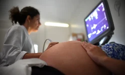 Apenas 3% dos pases tero taxa de fertilidade suficiente at 2100, diz estudo (foto: Arquivo/Andre Borges/Agncia Braslia)