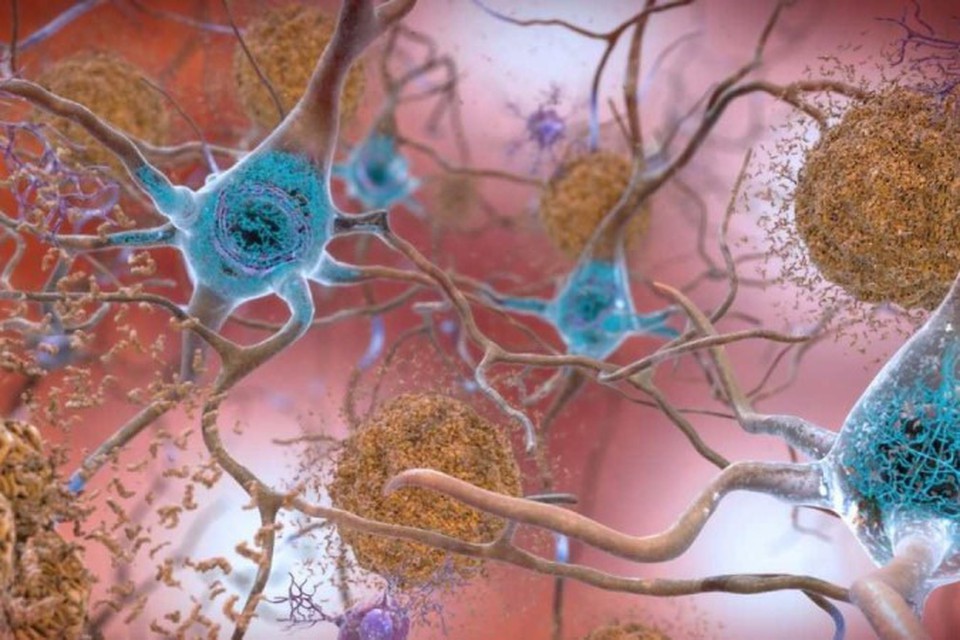  (Foto: National Institute on Aging, NIH/Divulgao)