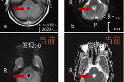 Ameba "comedora de crebro" provoca morte de mulher na China (foto: Reproduo/Revista Cientfica Heliyon)