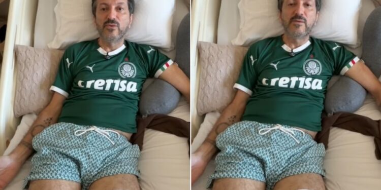 Lito sousa detalhe surge poucos