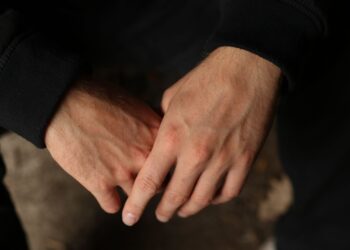 Mãos ressecadas ritual noturno poucos