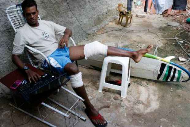 Jernimo Pereira da Paz  teve ferimentos graves na coxa esquerda e arranhes na perna direita. m Foto: Paulo Paiva/DP/D.A Press