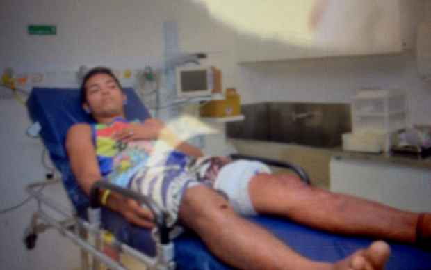 Diego foi atacado quando surfava com o irmo e dois amigos na praia de Del Chifre, em Olinda. Foto: Bombeiros/Divulgao