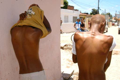 Meninos foram agredidos com cassetetes pelos Policiais Militares. Foto: Jlio Jacobina/DP/D.A Press