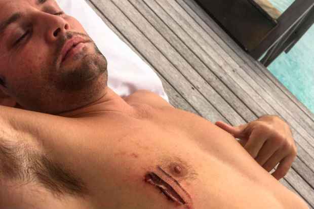 O amigo do cantor foi atacado no peito. Foto: Instagram/Reproduo
