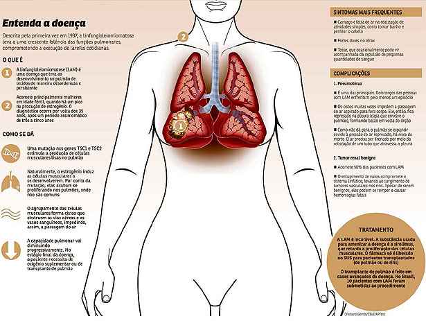Clique na imagem para ampli-la e saiba mais