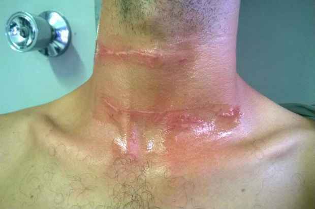 Motociclista de 31 anos foi atingido na altura do pescoço. Foto: Reprodução/ Facebook Motociclista de 31 anos foi atingido na altura do pescoço. Foto: Reprodução/ Facebook