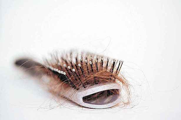  normal que se perca at 100 fios de cabelo por dia. Foto: Istock/Reproduo
