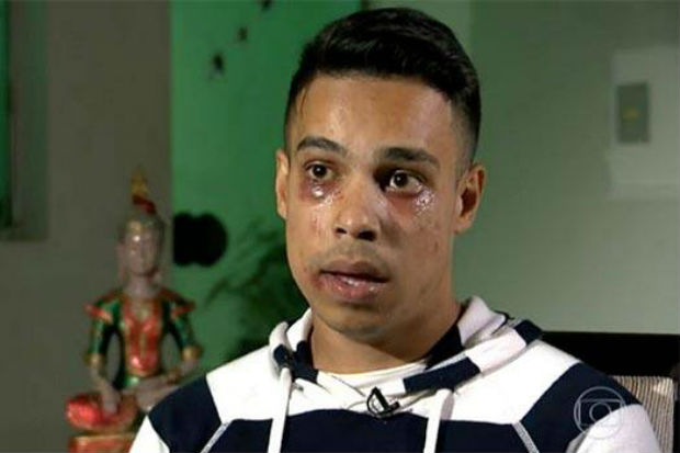 Um dos fs de Ivete Sangalo teve o rosto bastante machucado aps agresso de seguranas enquanto assistia
 a um show da artista. Foto: Reproduo/TV Globo