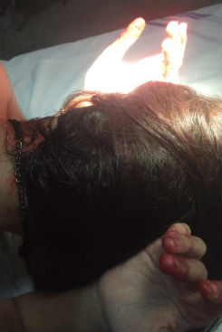 Passageira foi ferida na cabea e socorrida ao hospital. Foto: Reproduo/ WhatsApp