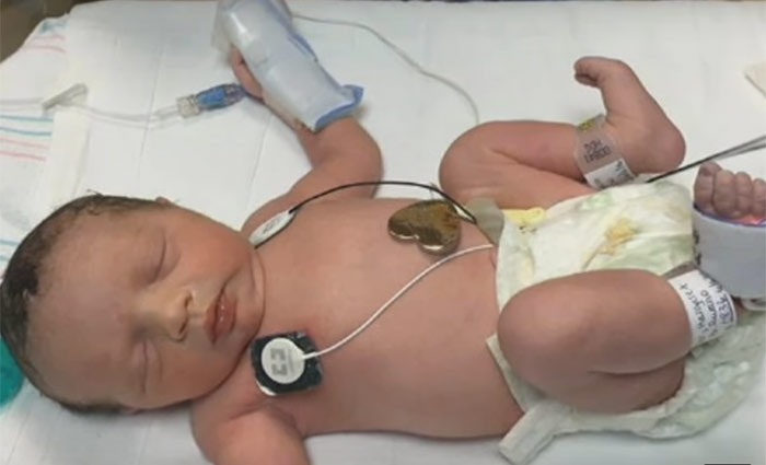Lynlee "nasceu pela segunda vez" em 6 de junho, atravs de uma cesariana feita prximo do fim da gravidez. Ela veio ao mundo saudvel e pesando 2,4 kg. Foto: Youtube/Reproduo