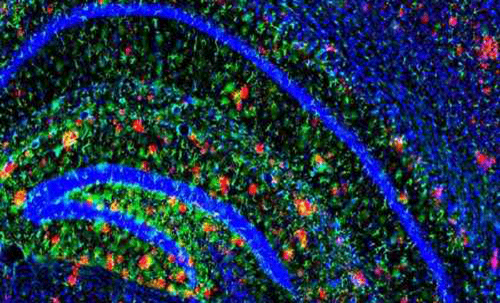 Placas amiloides (vermelho) no crebro de roedor com Alzheimer: formao prejudica o trabalho dos neurnios. Foto: John Cirrito/Divulgao (Placas amiloides (vermelho) no crebro de roedor com Alzheimer: formao prejudica o trabalho dos neurnios. Foto: John Cirrito/Divulgao)