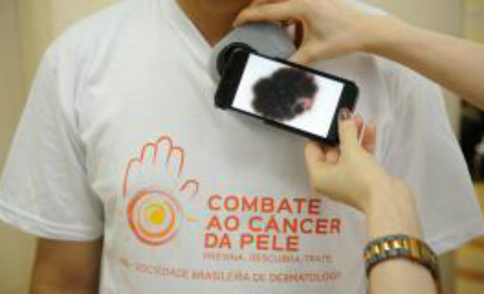 O Dia Nacional de Combate ao Câncer de Pele é lembrado em 26 de novembro. Foto: Arquivo/Agência Brasil/Fernando Frazão (Foto: Arquivo/Agência Brasil/Fernando Frazão) O Dia Nacional de Combate ao Câncer de Pele é lembrado em 26 de novembro. Foto: Arquivo/Agência Brasil/Fernando Frazão (Foto: Arquivo/Agência Brasil/Fernando Frazão)