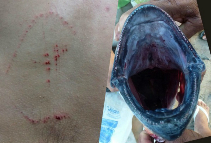 Comparativo do ferimento com a mordida do atum. Foto: Lo Veras/Reproduo (Comparativo do ferimento com a mordida do atum. Foto: Lo Veras/Reproduo)