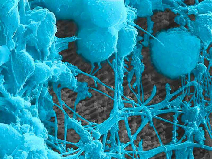 Neurnios (azul) crescem sobre a prtese: atuao em conjunto. Foto: UC San Diego/Divulgao