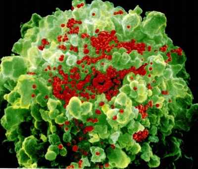 O vírus da Aids (vermelho) ataca células e se esconde em reservatórios. Foto: NIAID/Divulgação O vírus da Aids (vermelho) ataca células e se esconde em reservatórios. Foto: NIAID/Divulgação