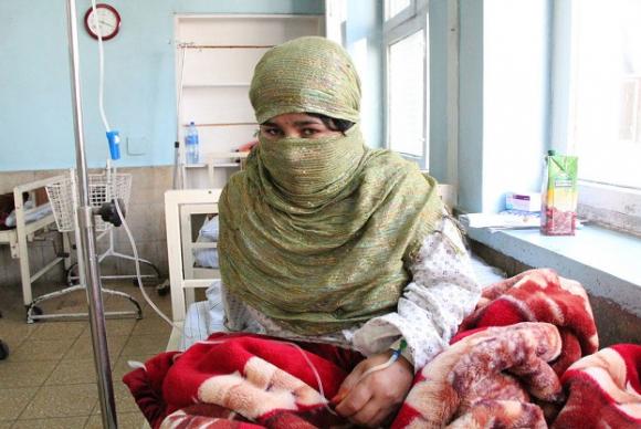 As pacientes com fstula obsttrica, como esta garota no Afeganisto, ficam com incontinncia urinria ou fecal, dor crnica e at depresso e isolamento social - Foto: Unfpa/Naes Unidas
