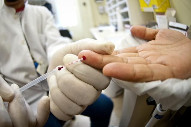 Ao todo, sero disponibilizados 300 testes para deteco de cada tipo de hepatite. Foto: Arquivo/Agncia Brasil 
