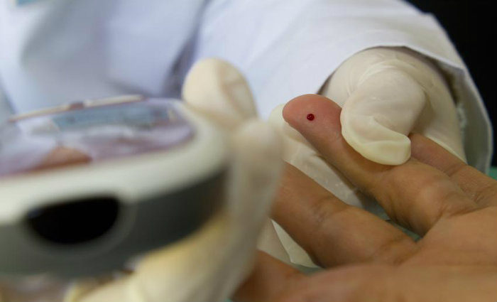O alvo da análise é o material genético criado por tumores e presente na corrente sanguínea dos pacientes. Foto: Marcos Santos/USP Imagens O alvo da análise é o material genético criado por tumores e presente na corrente sanguínea dos pacientes. Foto: Marcos Santos/USP Imagens