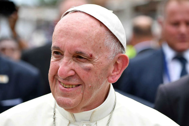 Sangramento no superclio do Papa Francisco foi controlado rapidamente. Crdito: Alberto Pizzolli/AFP