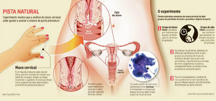 Para o novo estudo, foram coletadas amostras de muco cervical de dois grupos de mulheres durante a gestao e aps o parto. Foto: Reproduo