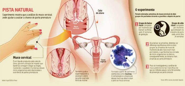 Para o novo estudo, foram coletadas amostras de muco cervical de dois grupos de mulheres durante a gestação e após o parto. Foto: Reprodução Para o novo estudo, foram coletadas amostras de muco cervical de dois grupos de mulheres durante a gestação e após o parto. Foto: Reprodução
