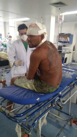 Confusão aconteceu às 10h, no pavilhão barbearia. Foto: Sindasp-PE/Divulgação (Confusão aconteceu às 10h, no pavilhão barbearia. Foto: Sindasp-PE/Divulgação) Confusão aconteceu às 10h, no pavilhão barbearia. Foto: Sindasp-PE/Divulgação (Confusão aconteceu às 10h, no pavilhão barbearia. Foto: Sindasp-PE/Divulgação)