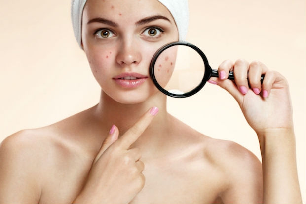 Higienizar a pele antes de dormir pode ajudar na luta contra o aparecimento da acne. Foto: Reprodução/Internet Higienizar a pele antes de dormir pode ajudar na luta contra o aparecimento da acne. Foto: Reprodução/Internet