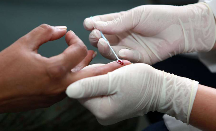 É bom lembrar que não protege o usuário contra outras infecções transmitidas sexualmente. Foto: Fotos Públicas É bom lembrar que não protege o usuário contra outras infecções transmitidas sexualmente. Foto: Fotos Públicas