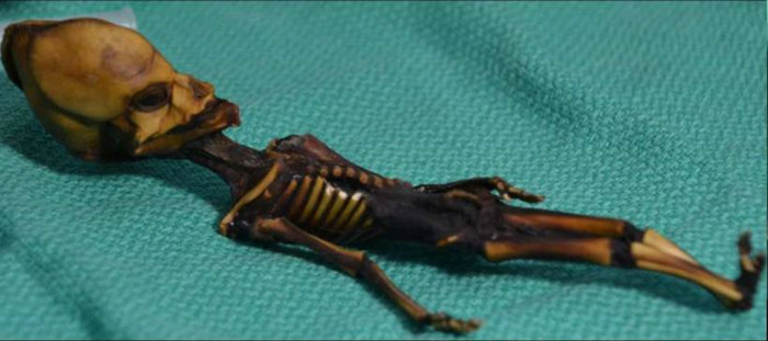 Anlise completa do genoma indica que esqueleto  de uma menina com vrias mutaes genticas. Foto: Bhattacharya S. et al/Reproduo (Foto: Bhattacharya S. et al/Reproduo)