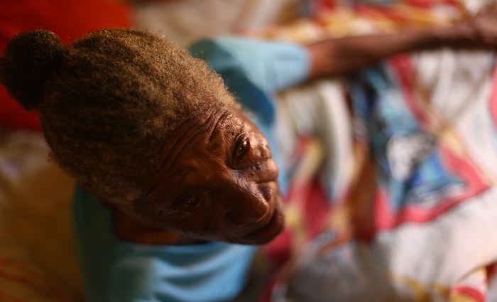 Judite  uma das moradoras mais antigas do lugar e hoje est de cama depois de perder uma das pernas. Foto: Peu Ricardo/DP