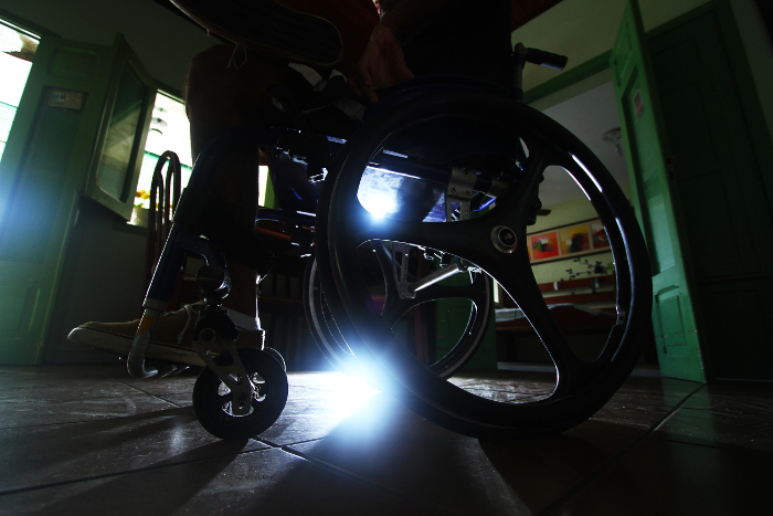 De cada 10 vítimas, uma sofre mutilação. Nordeste é a região com mais indenizados por acidentes com motos. Crédito: Peu Ricardo/DP (Crédito: Peu Ricardo/DP) De cada 10 vítimas, uma sofre mutilação. Nordeste é a região com mais indenizados por acidentes com motos. Crédito: Peu Ricardo/DP (Crédito: Peu Ricardo/DP)