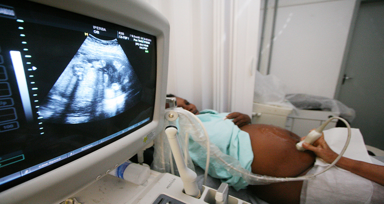 Na pesquisa, filhos de grávidas com obesidade tinham em média 100g a mais e ossos do corpo maiores. Foto: 	Mateus Pereira/SECOM