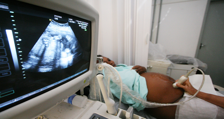 Na pesquisa, filhos de grvidas com obesidade tinham em mdia 100g a mais e ossos do corpo maiores. Foto: 	Mateus Pereira/SECOM