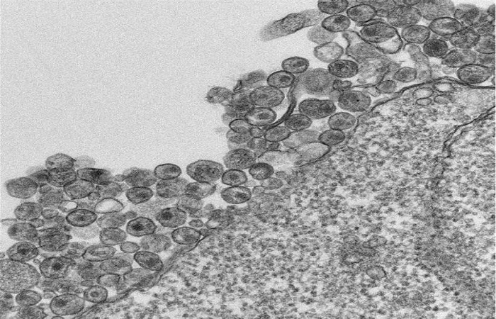 Imagem de microscópio mostra vírus HIV acumulado na superfície de uma célula. Foto: University of Missouri Health System/Divulgação (Imagem de microscópio mostra vírus HIV acumulado na superfície de uma célula. Foto: University of Missouri Health System/Divulgação)