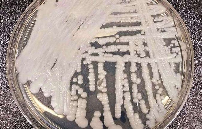 O superfungo Candida auris se prolifera quando o sistema imunolÃ³gico estÃ¡ debilitado: transmissÃ£o por contato. FOTO:  CDC/DivulgaÃ§Ã£o (O superfungo Candida auris se prolifera quando o sistema imunolÃ³gico estÃ¡ debilitado: transmissÃ£o por contato. FOTO:  CDC/DivulgaÃ§Ã£o)