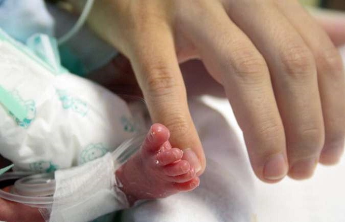 Nascidos antes da 32 semana gestacional, os microprematuros pesam menos de 1,5kg: benefcios neurolgicos sob todos os aspectos avaliados pelos especialistas. Foto: Monique Renne/Esp. CB/D.A Press (Nascidos antes da 32 semana gestacional, os microprematuros pesam menos de 1,5kg: benefcios neurolgicos sob todos os aspectos avaliados pelos especialistas. Foto: Monique Renne/Esp. CB/D.A Press)