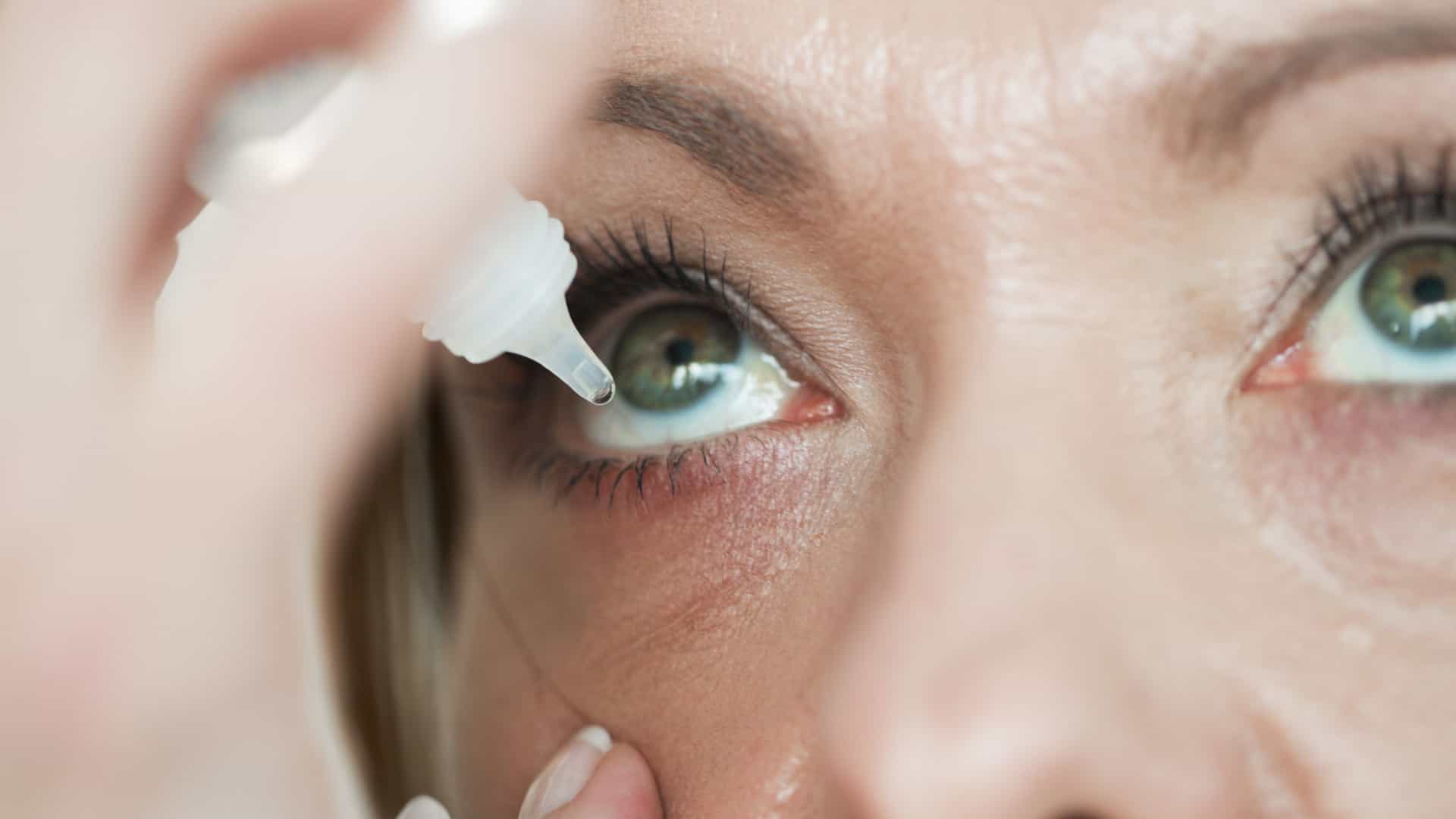 Sndrome do Olho Seco se caracteriza pela falta de lubrificao nos olhos. Foto: Reproduo da internet