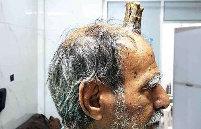 Foto: Divulgação/Goal Post Media Foto: Divulgação/Goal Post Media