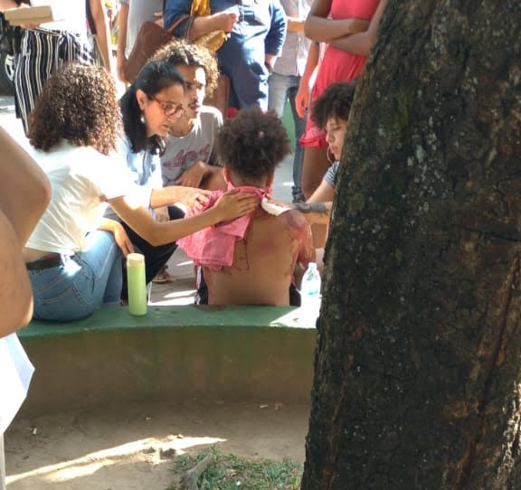 Vítima recebeu primeiro atendimento ainda no Centro de Educação. Foto: WhatsApp/Reprodução