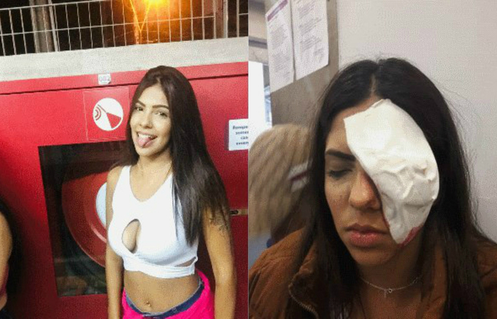 Segunda a mãe, a jovem retornava para a adega quando uma viatura da PM passou ao lado da adolescente e atirou contra a jovem com uma arma de bala de borracha (Foto: Reprodução/Facebook/Arquivo pessoal) Segunda a mãe, a jovem retornava para a adega quando uma viatura da PM passou ao lado da adolescente e atirou contra a jovem com uma arma de bala de borracha (Foto: Reprodução/Facebook/Arquivo pessoal)