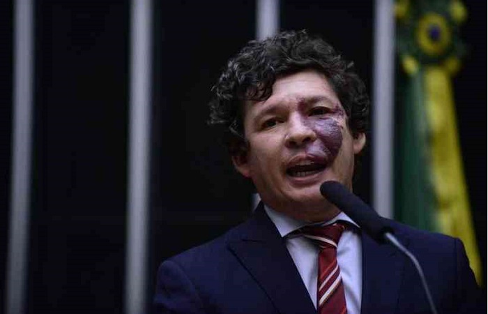 Deputado Reginaldo Lopes: ''Muitos gastos pblicos sero feitos sem licitao (...), precisamos saber como esto sendo feitos esses gastos''
 (Foto: Nilson Bastian/ Cmara dos Deputados)