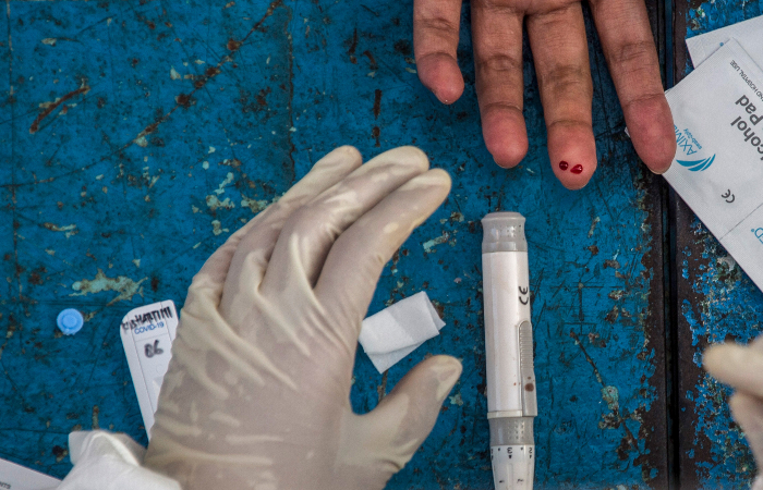 Pelo terceiro dia, Pernambuco contabiliza mais casos leves do que graves do novo coronavírus. (Foto: Juni Kriswanto/AFP.)