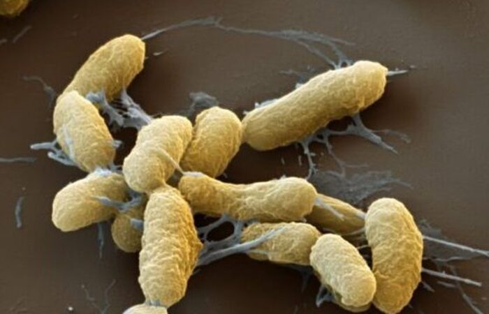 A bactéria Yersinia pestis, causadora da peste bubônica
(Foto: Reprodução/Organização Pan-Americana da Saúde) A bactéria Yersinia pestis, causadora da peste bubônica
(Foto: Reprodução/Organização Pan-Americana da Saúde)