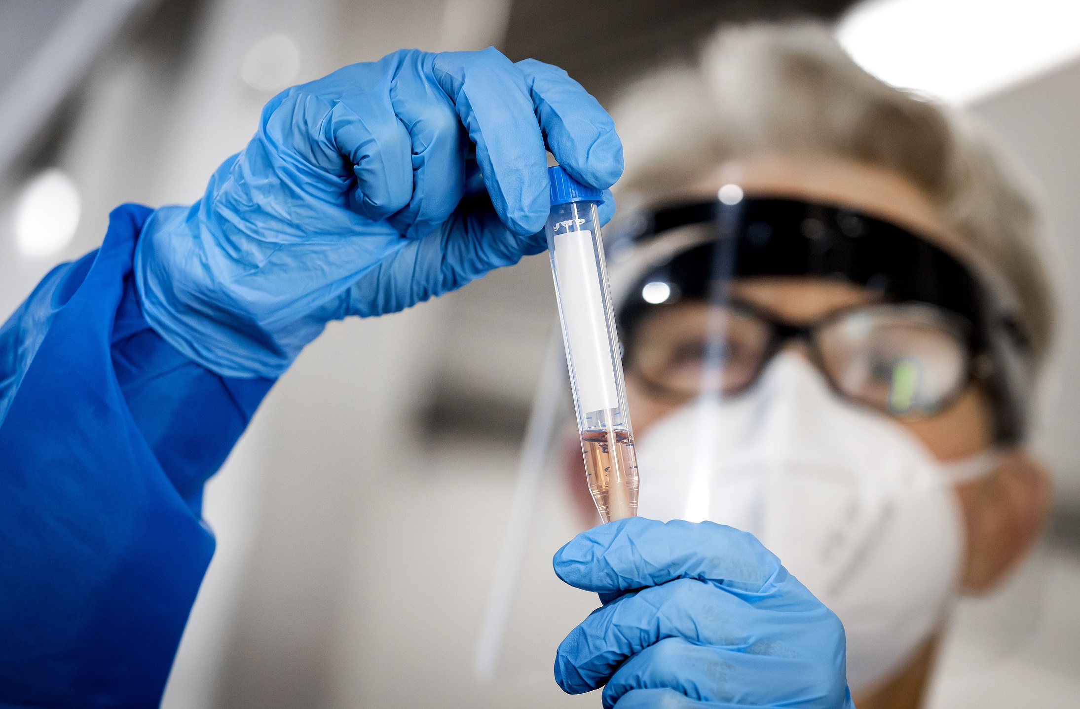 Vacina Da Oxford Preveniu Pneumonia De Covid 19 Em Macacos Ciencia E Saude Diario De Pernambuco Vacina Da Oxford Preveniu Pneumonia De Covid 19 Em Macacos Ciencia E Saude Diario De Pernambuco