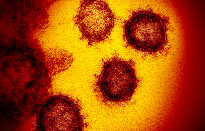 Trata-se de um quadro que acomete crianças e adolescentes possivelmente relacionado à Covid-19 (NIAID-RML) Trata-se de um quadro que acomete crianças e adolescentes possivelmente relacionado à Covid-19 (NIAID-RML)