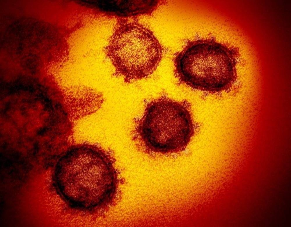 (Foto: AFP / National Institutes of Health / Handout) (Foto: AFP / National Institutes of Health / Handout)
